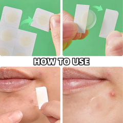 12/48 hydrocolloid individually packaged acne patches | Professional skincare, fast absorption of pus and oil | Invisible and wa