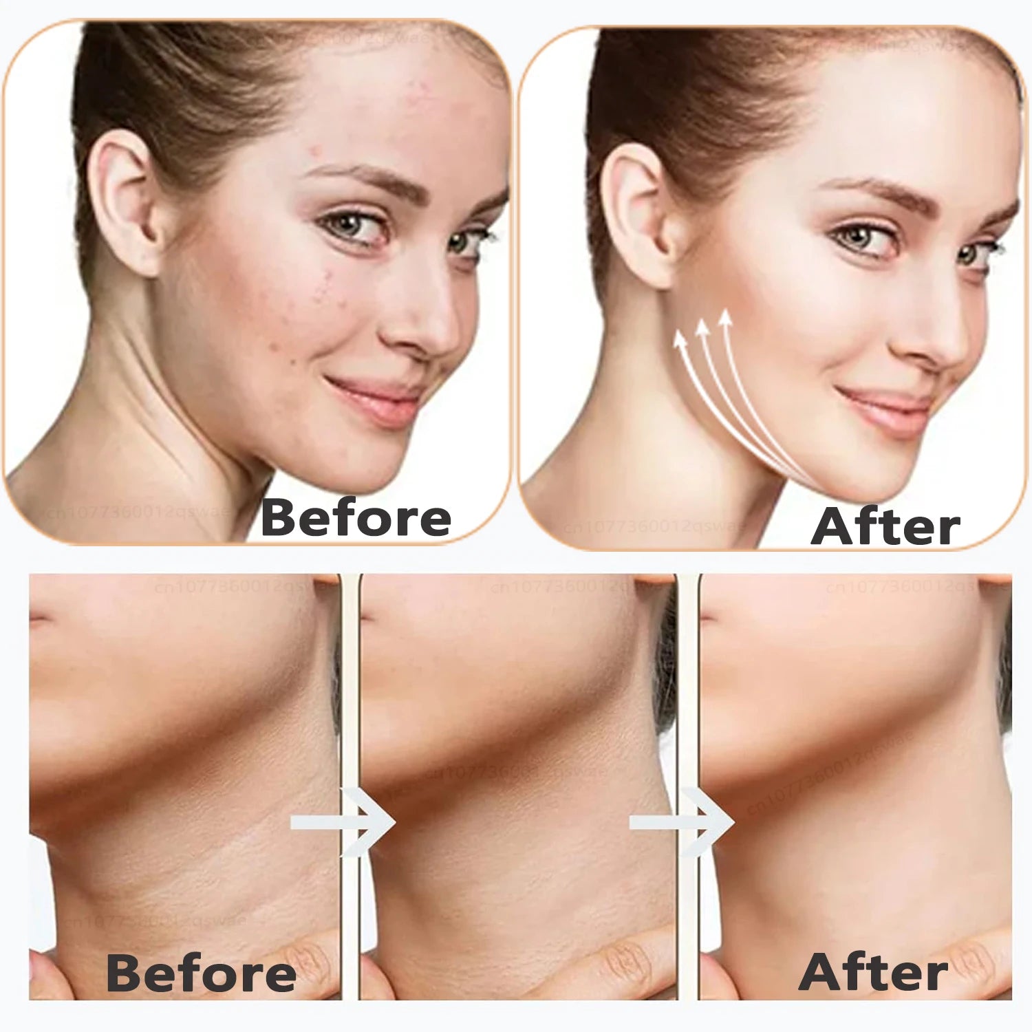 Neck Face Beauty Device EMS Micro-current 7 Color Facial Massager Reduce Double Chin Skin Tightening Neck Lift Device