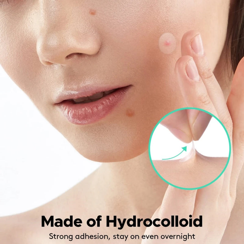 360 pieces of skin-colored hydrocolloid acne patches | Gentle skin care, waterproof and breathable, day and night care, facial s